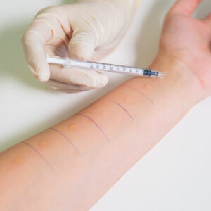 Here’s how you can get your allergies detected