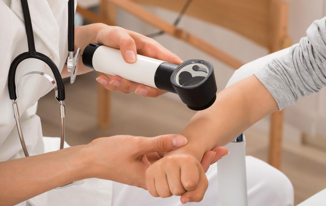 Eczema – Symptoms, Complications, and Treatment Options