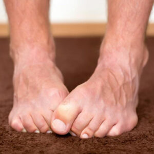 Neuropathy Foot Pain – Symptoms, Causes, Treatments and More
